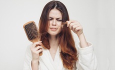 C&#225;c phương ph&#225;p chữa trị rụng t&#243;c v&#224; t&#225;c dụng phụ n&#234;n biết
