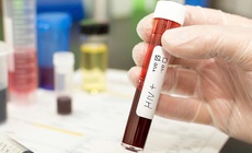 Ph&#225;t hiện HIV ở thai phụ khi chuyển dạ: Th&#225;ch thức v&#224; nguy cơ tiềm ẩn