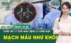 Bản Tin Y Tế 27/9: Mắc hội chứng hiếm, thiếu nữ 17 tuổi c&#243; mạch m&#225;u n&#227;o li ti lan toả như kh&#243;i thuốc