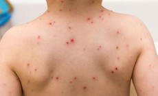 3 bệnh thường gặp ở trẻ vào mùa xuân