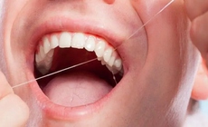 Chăm sóc tốt răng miệng giúp phòng tránh nhiều bệnh lý nguy hiểm.