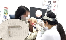 Ghim tất sắc nhọn mắc trong họng bé trai