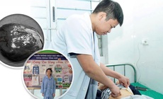 Phẫu thuật cắt lách bán phần điều trị u nang lách khổng lồ