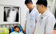 Cứu lá phổi suýt bị hủy hoại do tràn mủ màng phổi phức tạp