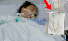 Người phụ nữ 48 tuổi phát hiện sán dây bò dài 70cm dù không có triệu chứng