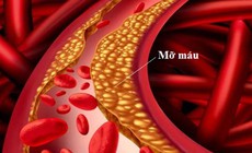 Triglyceride cao gây viêm tụy cấp nguy hiểm đe doạ tính mạng