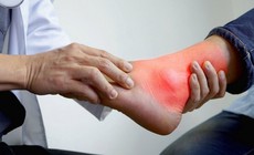 Bệnh gout không chỉ do ăn uống