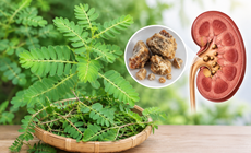 Cách dùng cây chó đẻ hỗ trợ điều trị sỏi tiết niệu