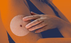 Vaccine ung thư mới giúp giảm 42% nguy cơ tái phát u hắc tố