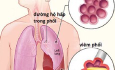 5 cách giúp chủ động phòng ngừa viêm phổi khi chuyển mùa