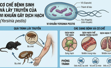 Dịch hạch nguy hiểm thế nào, tại sao chưa tiêm vaccine đại trà?