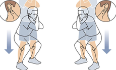 Thiếu niên nhập viện vì hội chứng ly giải cơ vân sau thụt dầu 300 cái