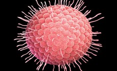 Mùa xuân cảnh giác với bệnh thủy đậu