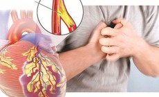 Lối sống thiếu lành mạnh, stress kéo dài khiến bệnh tim mạch dần trẻ hoá