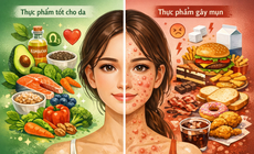Ăn gì để da sạch mụn, mịn màng?