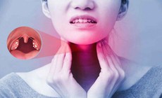 Viêm amidan tái phát có nên cắt không?