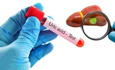 Cách dùng cần tây hỗ trợ giảm axit uric tại nhà: Lợi ích và những điều cần lưu ý