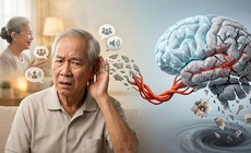 Suy giảm thính lực có thể làm tăng nguy cơ sa sút trí tuệ