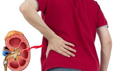 Suy thận không phải do tuổi tác: Thủ phạm nằm ngay trên mâm cơm của bạn