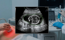 Nước ối ít và biến chứng thai kỳ: 'Cảnh báo đỏ' mẹ bầu cần lưu tâm