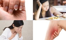 5 dấu hiệu cơ thể đang 'kêu cứu' vì thiếu vi chất trầm trọng