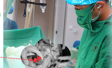 Giành lại sự sống cho bệnh nhân vỡ tử cung nguy kịch