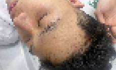 Công an Hà Nội điều tra vụ nam sinh bị nhóm đi ô tô ngược chiều chặn đầu, đánh hội đồng nhập viện