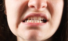 Lệch khớp cắn có gây bệnh lý răng miệng?