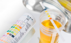 Làm thế nào để nhận biết trẻ bị rối loạn đi tiểu?