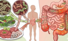 Dễ mắc nhiễm khuẩn đường ruột trong mùa hè từ thói quen ăn đồ sống