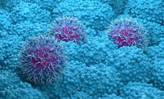 Lộ diện loại thuốc sẽ mở ra hy vọng sống cho người ung thư tụy