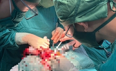 Cắt bỏ khối u giáp khổng lồ nằm sát mạch máu lớn và dây thần kinh 