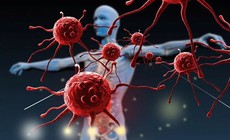 Những bộ phận nào trên cơ thể thường gây ung thư và cách phòng tránh hiệu quả