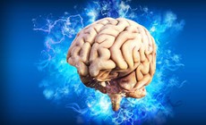 Công nghệ AI giúp cứu sống hàng triệu tế bào não cho bệnh nhân đột quỵ