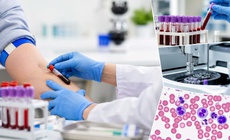Những xét nghiệm cơ bản ai cũng nên làm