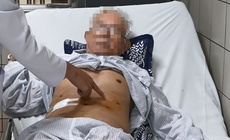 Ung thư có thể tái phát nếu chủ quan sau điều trị