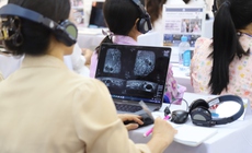 Lần đầu đào tạo siêu âm vú 3D mô phỏng thực tế ảo tại TPHCM, tăng khả năng phát hiện sớm ung thư
