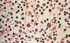Tỷ lệ tử vong do nhiễm virus Hanta tăng cao, Chile nâng mức cảnh báo y tế