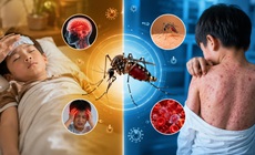 Đừng xem nhẹ những cơn sốt mùa hè