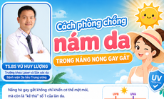 Cách phòng chống nám da, tàn nhang trong nắng nóng gay gắt