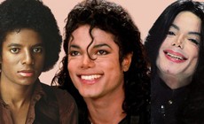 Sự thật về căn bệnh hiếm khiến Michael Jackson phải tẩy trắng da