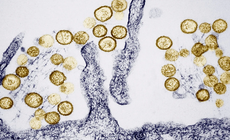 WHO đánh giá nguy cơ lây lan virus Hanta trong cộng đồng ở ‘mức thấp’