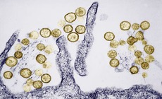 Hantavirus khiến 3 người trên du thuyền MV Hondius tử vong nguy hiểm ra sao?