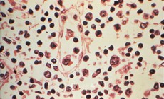 Đài Loan (Trung Quốc) ghi nhận 1 ca tử vong do nhiễm virus Hanta