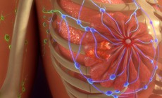 Công nghệ điều trị ung thư mới không cần dùng thuốc