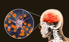Hà Nội ghi nhận ca viêm não Nhật Bản, bác sĩ khuyến cáo cách phòng bệnh hiệu quả