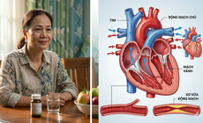Mãn kinh sớm làm tăng 40% nguy cơ mắc bệnh tim mạch suốt đời