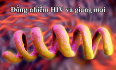 Đồng nhiễm HIV và giang mai: Tầm soát định kỳ để ngăn chặn biến chứng tổn thương thần kinh