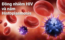 Đồng nhiễm HIV và nấm Histoplasmosis: Phát hiện sớm để giảm nguy cơ tổn thương phổi và tử vong