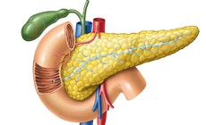 Tăng mỡ máu có thể gây viêm tụy cấp nguy hiểm đến tính mạng